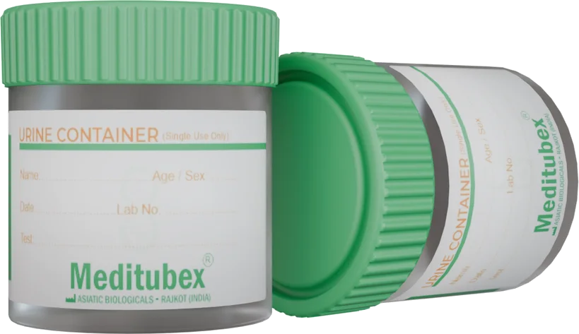 Urine Container blood collection tube — view 1
